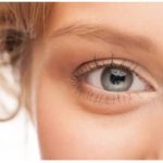 TRATAMIENTOS NATURALES PARA OJOS INCHADOS