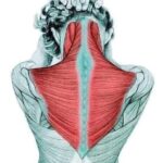 EL CUELLO ME DOLÍA MUCHO