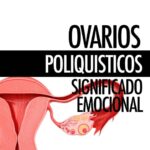 Ovarios Poliquisticos